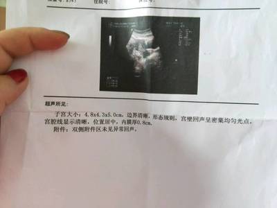 做完人流半个月来月经