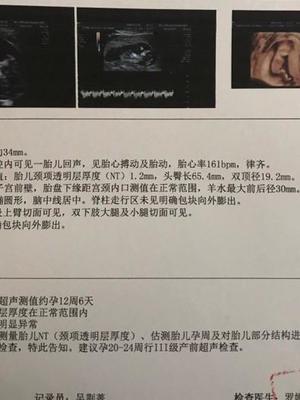 胎儿14周会有胎动吗