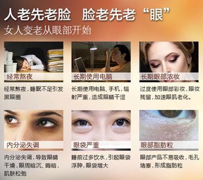 怎么治疗大眼袋