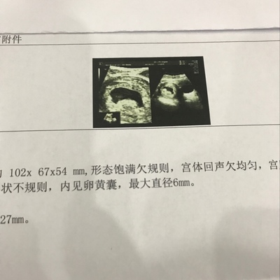 怀孕8周胎芽多大正常