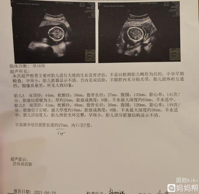 十八周胎儿发育图片