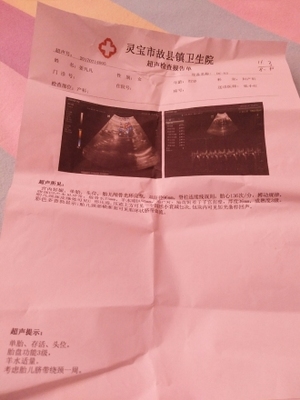 怀孕36周是多少个月