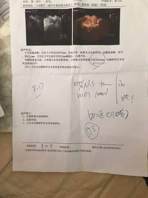 卵泡一个月有几个