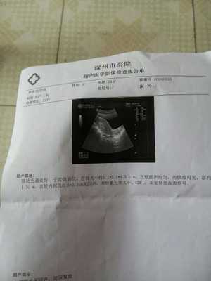 怀孕会出血嘛