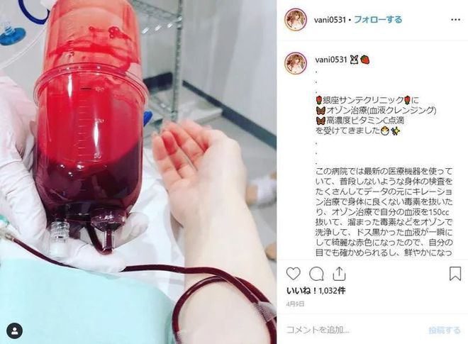 换血美容