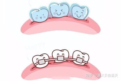 拔牙前注意什么