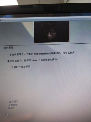 怀孕多少周有胚芽