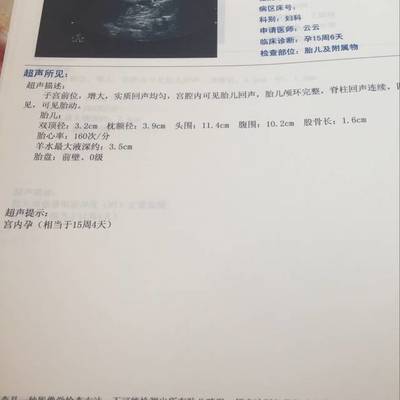 孕15周胎儿