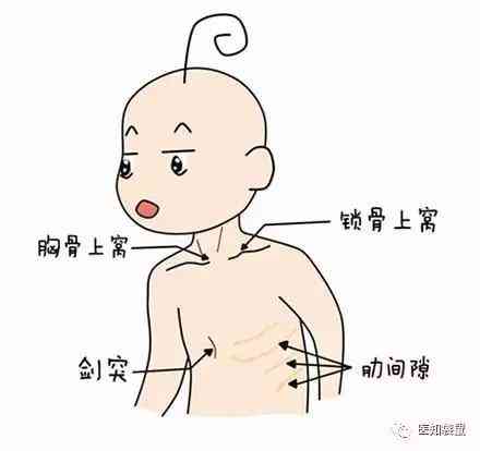 新生儿喉咙沙哑