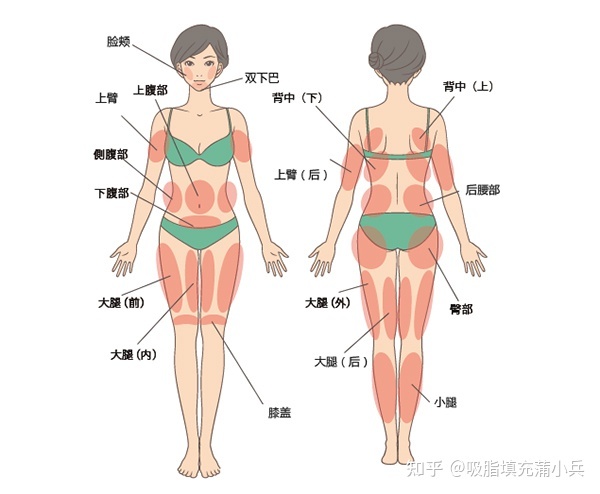 抽脂的危害