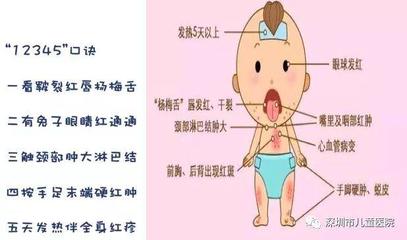 感冒手脚发热是怎么回事