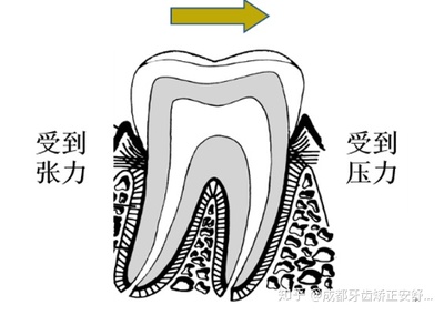 怀孕可以整牙吗