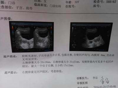 没有成熟的卵泡会怀孕吗