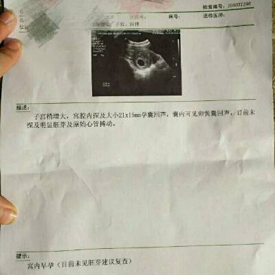 怀孕两个月流血了怎么办