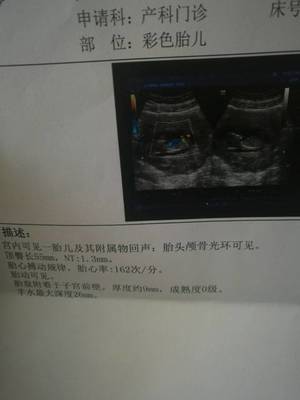 听诊器对胎儿有影响吗