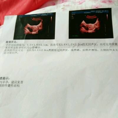 怀孕35天能看到孕囊吗