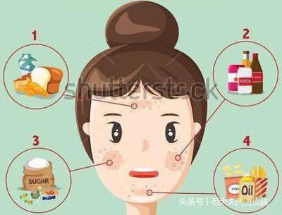 祛痘不能吃什么