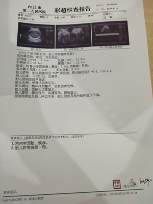 孕38加5周羊水多少为正常