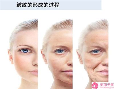 玻尿酸适合什么皮肤