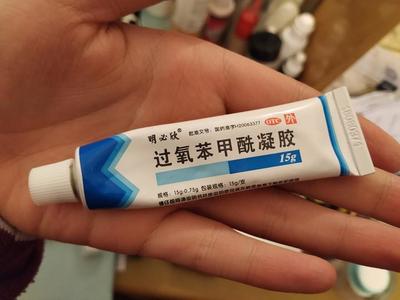过氧苯甲酰凝胶可以祛痘印吗