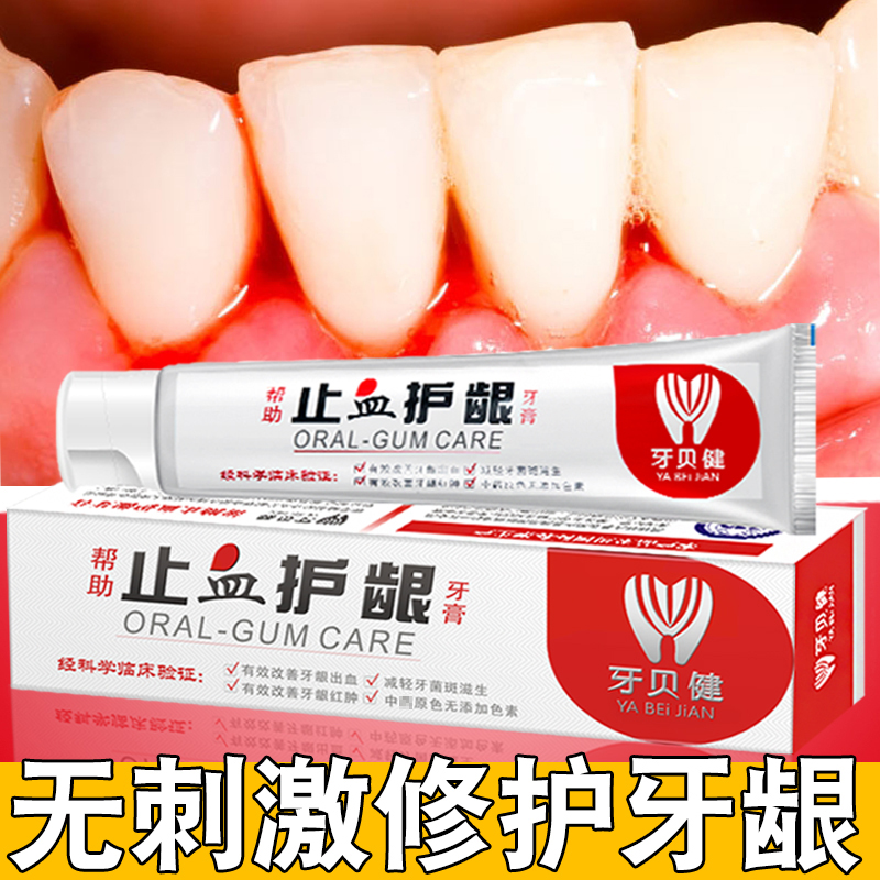 孕妇可以用含氟牙膏吗