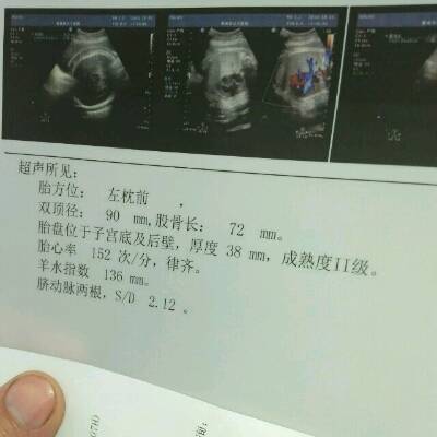 孕35周几个月
