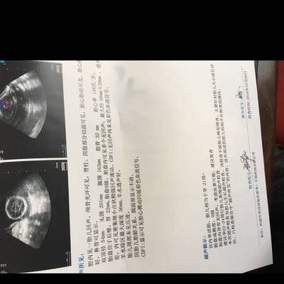 十八周胎儿发育图片