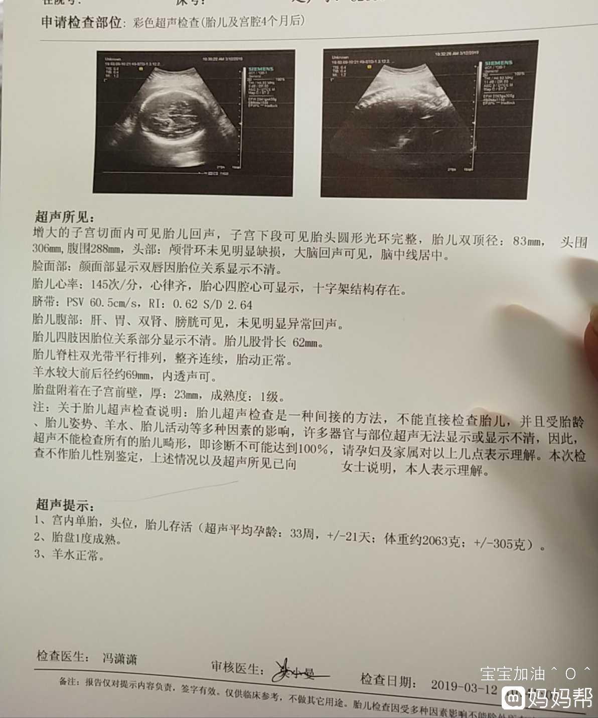 4个月胎儿图片