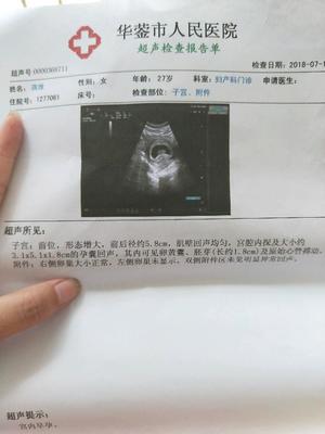 胎儿心跳是什么声音