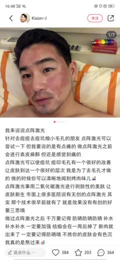 微针能不能去痘痘