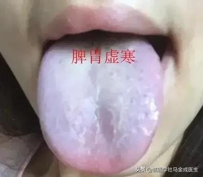 胃胀拉肚子吃什么药