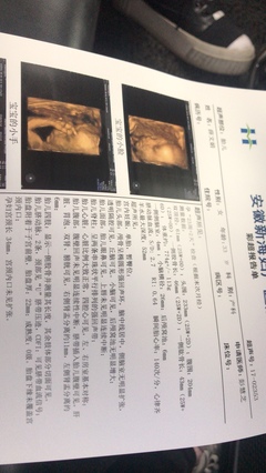 孕妇肾盂分离是什么意思