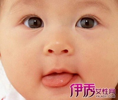 舌头苦是怎么回事