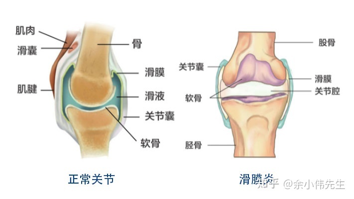 髌骨疼痛怎么治疗