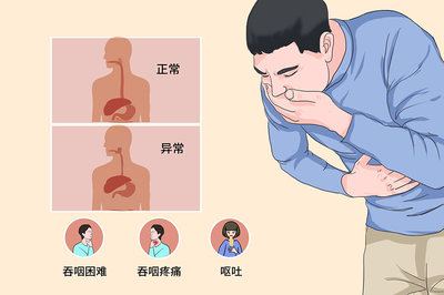 食道疼是怎么回事