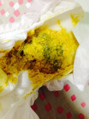 宝宝拉黑粑粑