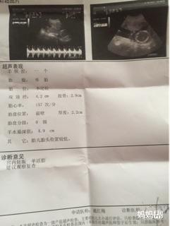 做梦梦见自己早产
