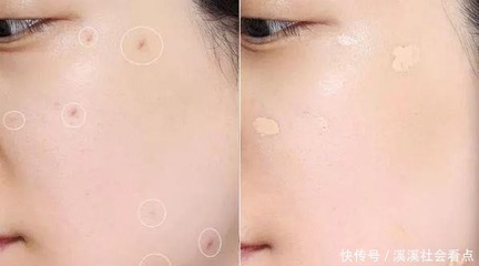 一涂粉底就长痘痘