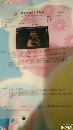 怀孕两周胎儿有多大