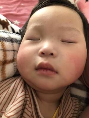 脸发白是怎么回事