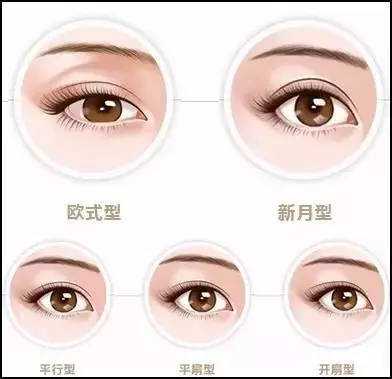 想做双眼皮