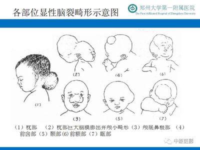 宝宝做核磁共振危害