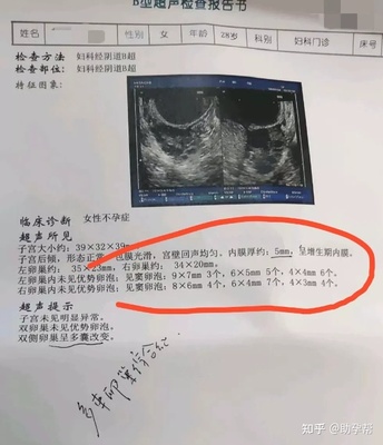 没有优势卵泡怎么治疗