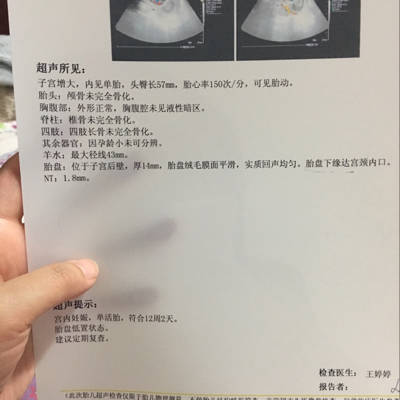 怀孕位置低
