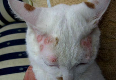 人长猫癣怎么治疗