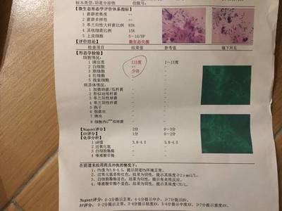 流绿色白带是怎么回事