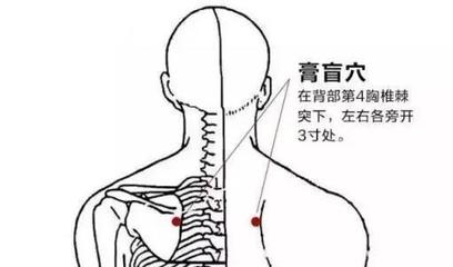 后背胀是怎么回事