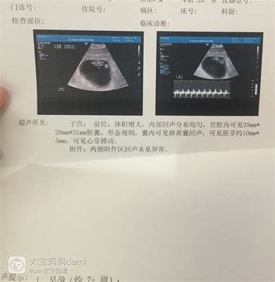听诊器对胎儿有影响吗