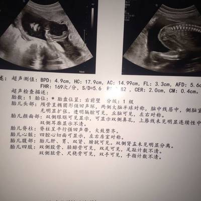 怎么测试男女宝宝最准