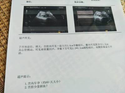 怀孕初期流血怎么办